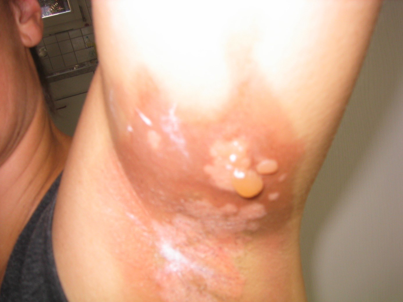 Bild9